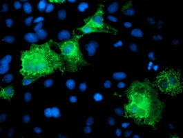 KATNB1 Antibody in Immunocytochemistry (ICC/IF)