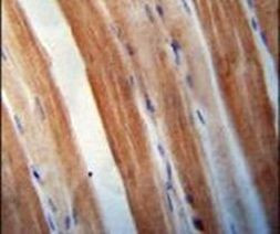 KBTBD5 Antibody in Immunohistochemistry (IHC)