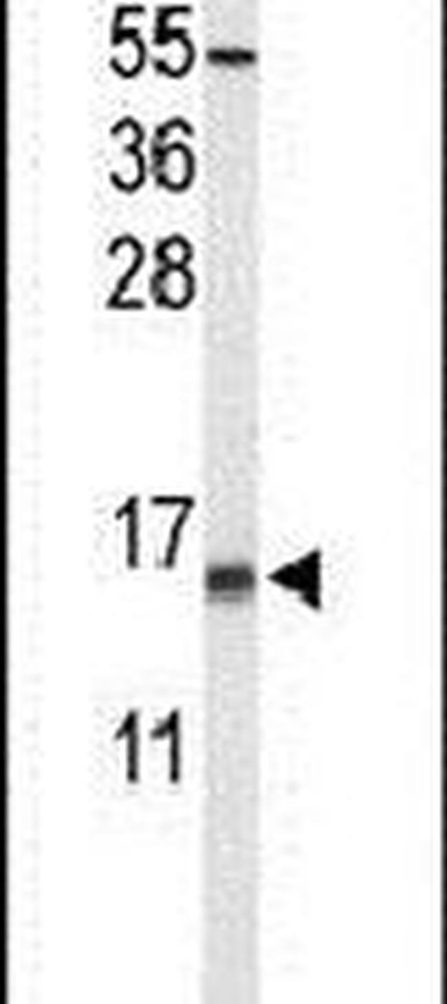 KCNE1L Antibody in Western Blot (WB)