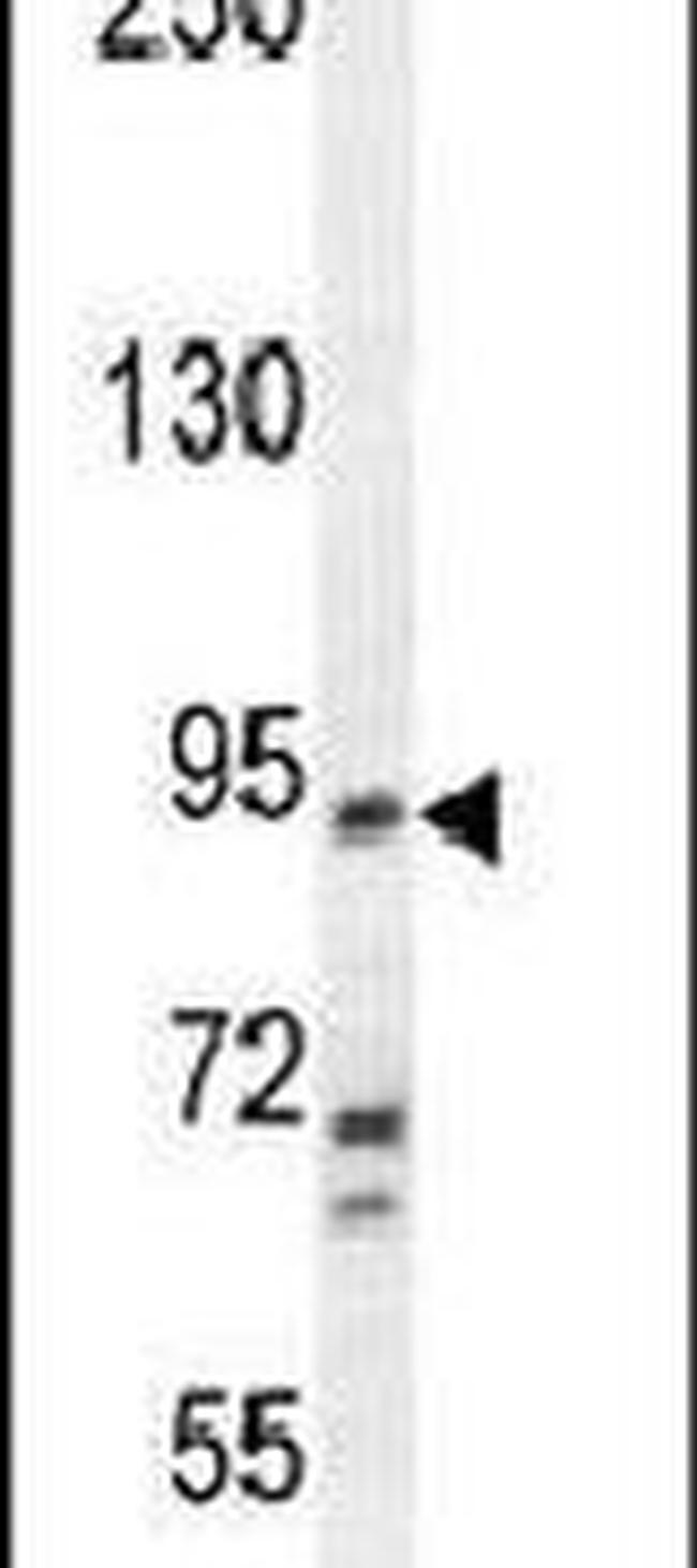 KCNH4 Antibody in Western Blot (WB)