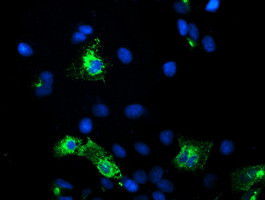 KCNJ3 Antibody in Immunocytochemistry (ICC/IF)