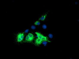 KCNJ3 Antibody in Immunocytochemistry (ICC/IF)