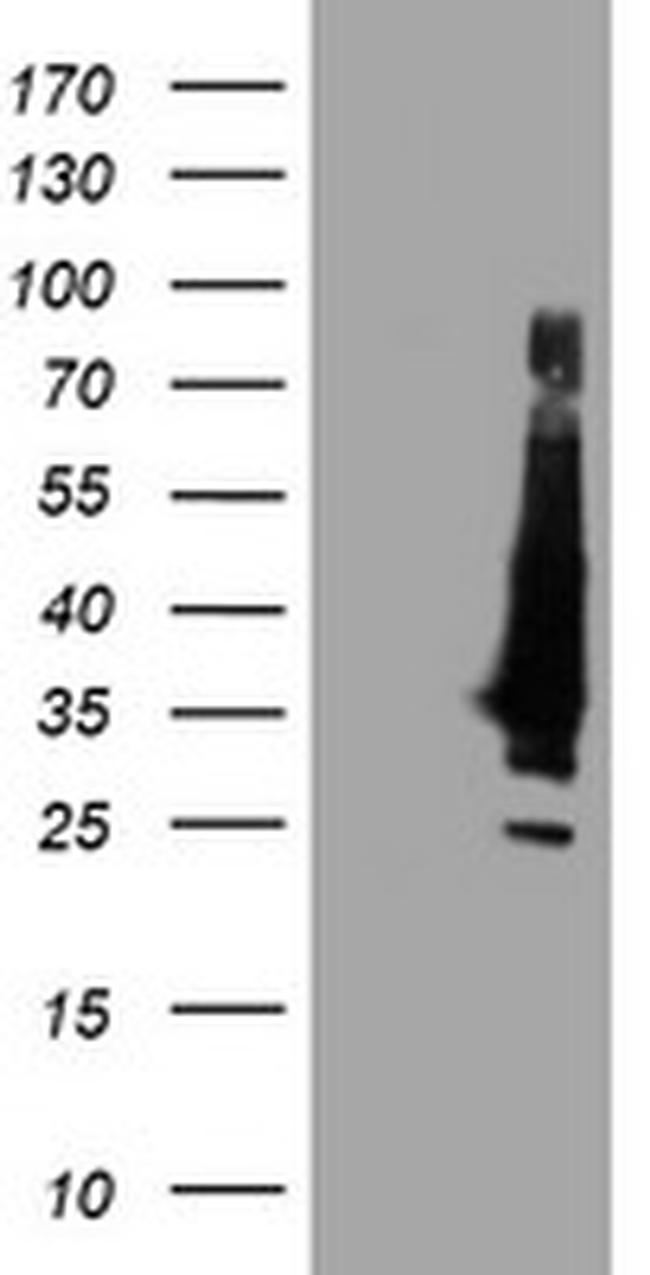 KCNJ3 Antibody in Western Blot (WB)