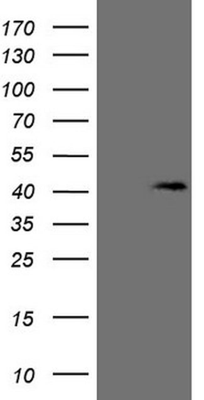 KCTD13 Antibody in Western Blot (WB)