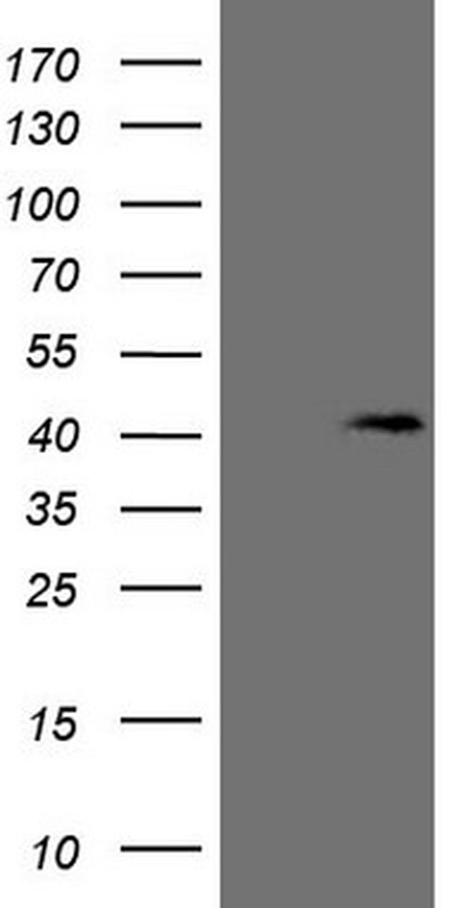 KCTD13 Antibody in Western Blot (WB)