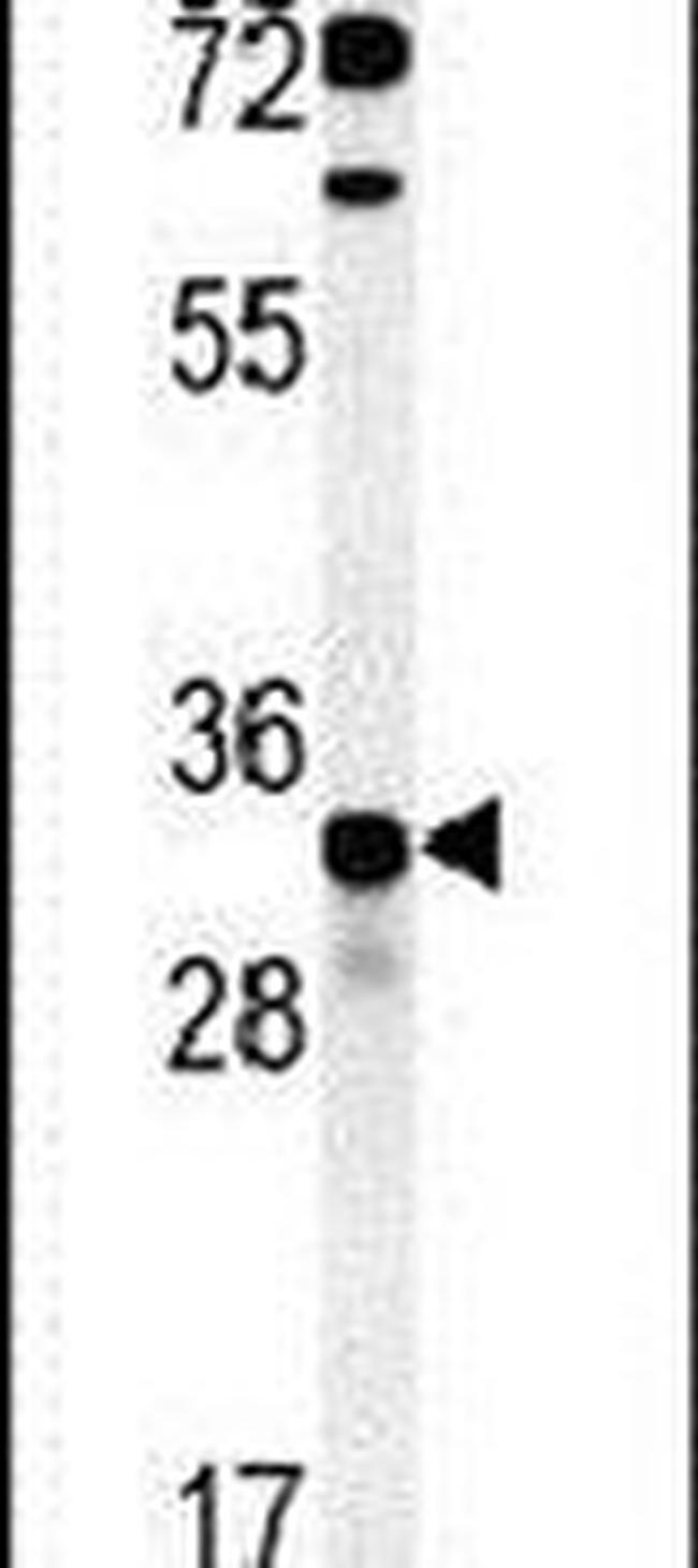 KCTD15 Antibody in Western Blot (WB)