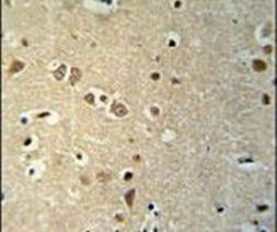KCTD21 Antibody in Immunohistochemistry (IHC)