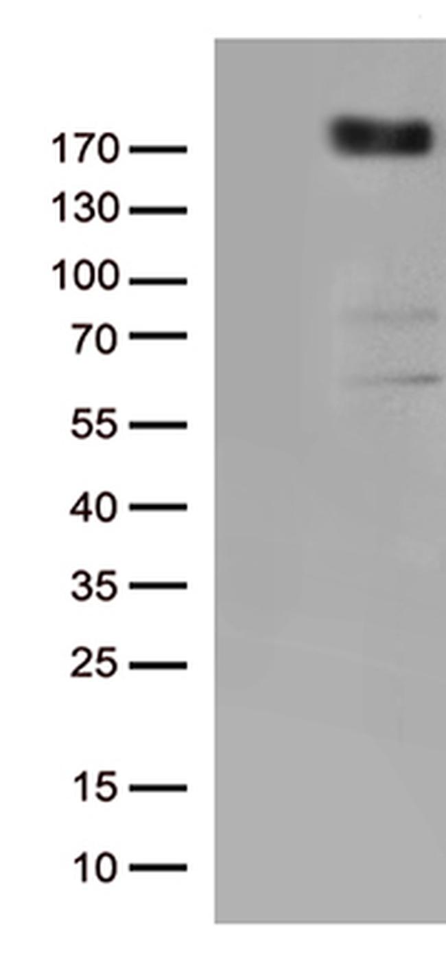 KDR Antibody in Western Blot (WB)