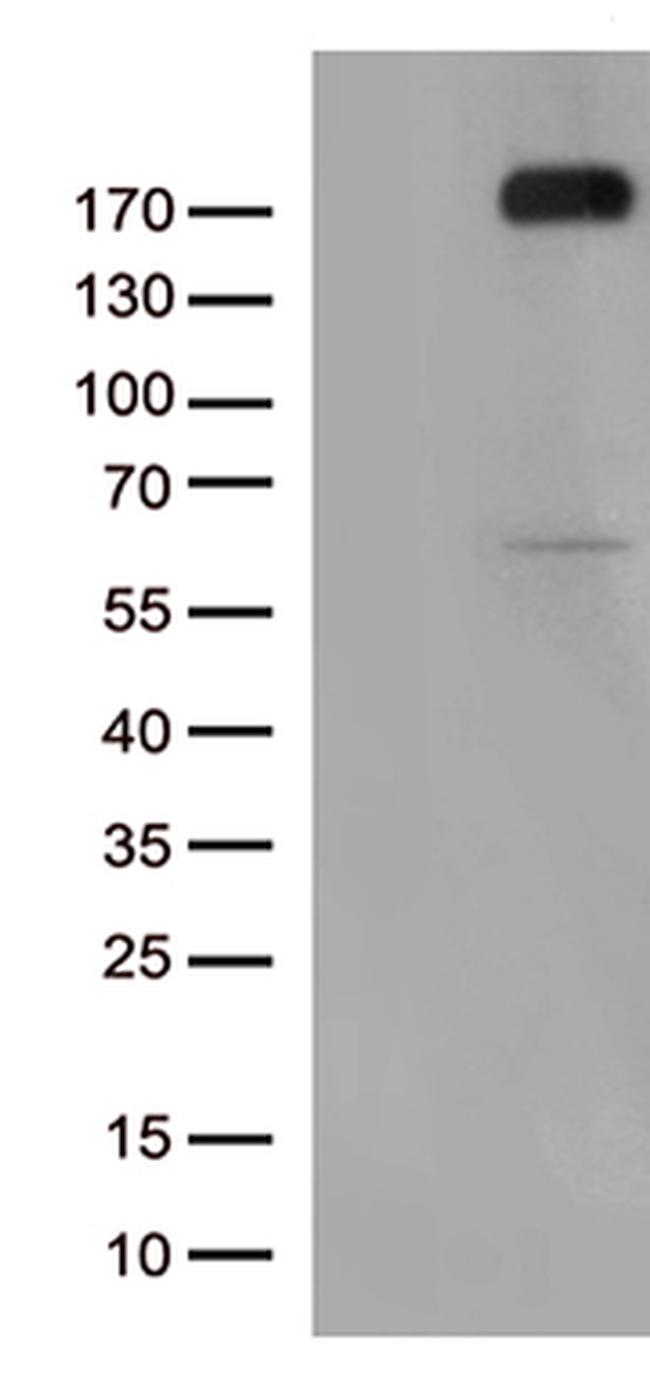 KDR Antibody in Western Blot (WB)