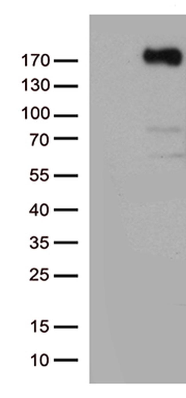 KDR Antibody in Western Blot (WB)