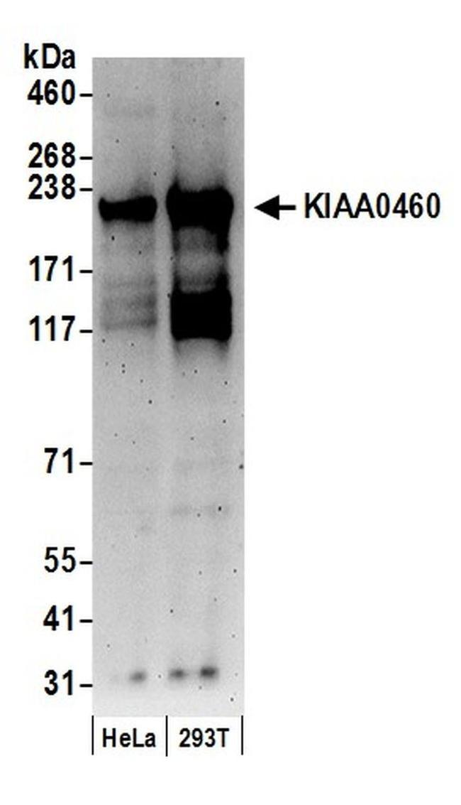 KIAA0460 Antibody in Western Blot (WB)