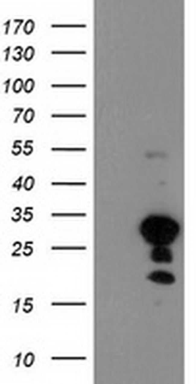 KIAA0495 Antibody in Western Blot (WB)