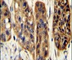 KIAA1324L Antibody in Immunohistochemistry (IHC)