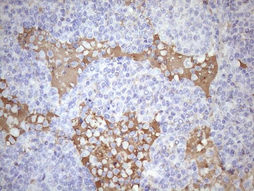 KIAA1524 Antibody in Immunohistochemistry (Paraffin) (IHC (P))