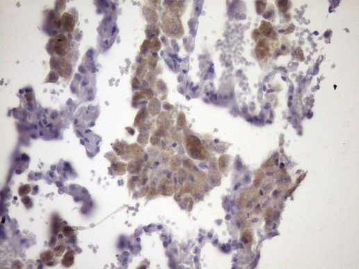 KIAA1524 Antibody in Immunohistochemistry (Paraffin) (IHC (P))