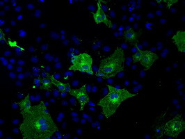 KIAA1609 Antibody in Immunocytochemistry (ICC/IF)
