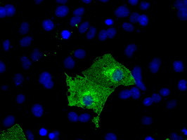 KIAA1609 Antibody in Immunocytochemistry (ICC/IF)