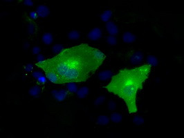 KIAA1609 Antibody in Immunocytochemistry (ICC/IF)