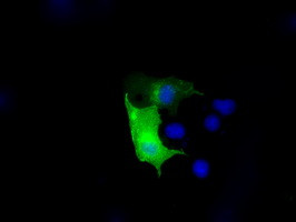 KIAA1609 Antibody in Immunocytochemistry (ICC/IF)