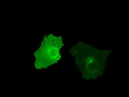 KIAA1609 Antibody in Immunocytochemistry (ICC/IF)