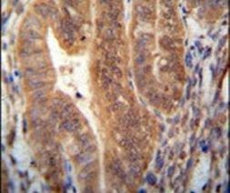 KIAA1644 Antibody in Immunohistochemistry (IHC)