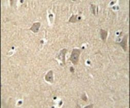 KIAA1680 Antibody in Immunohistochemistry (IHC)
