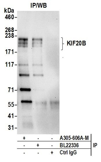 KIF20B Antibody in Immunoprecipitation (IP)