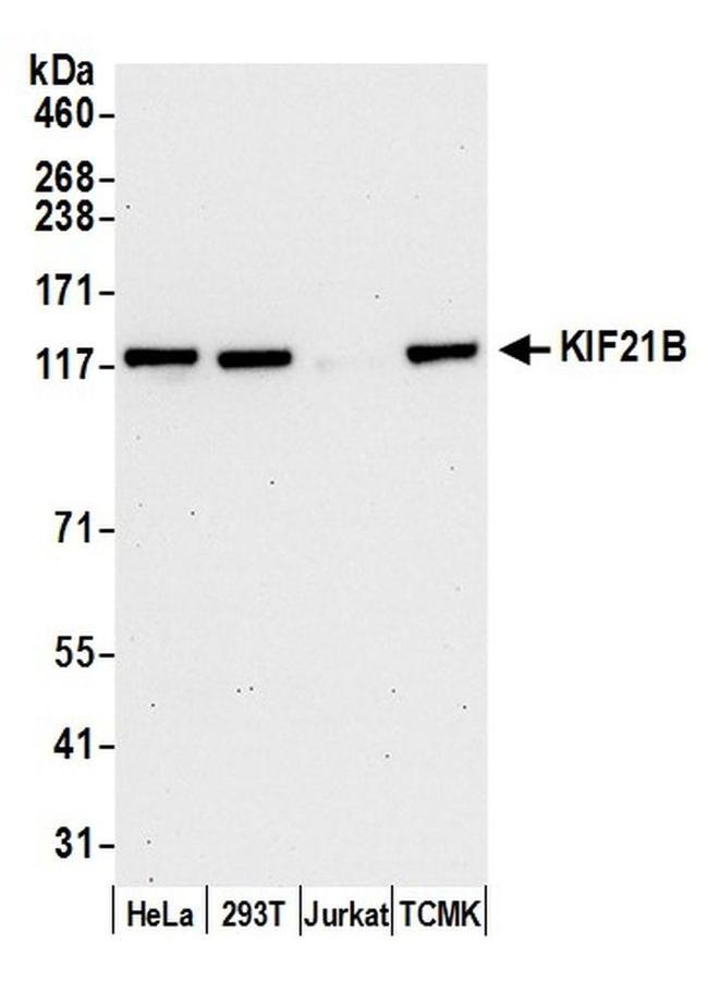 KIF21B Antibody in Western Blot (WB)