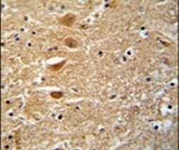 KIF3C Antibody in Immunohistochemistry (IHC)