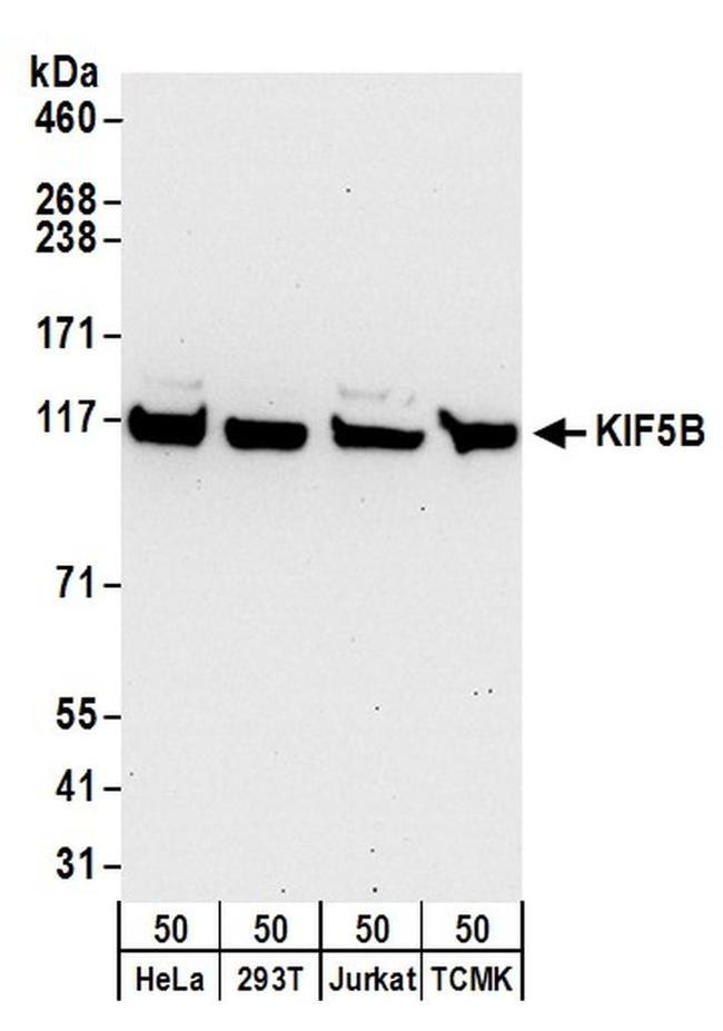 KIF5B Antibody in Western Blot (WB)