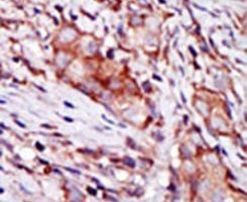 KIP2 Antibody in Immunohistochemistry (IHC)