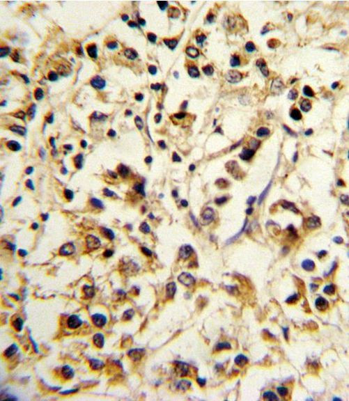 KIR2DL4 Antibody in Immunohistochemistry (IHC)