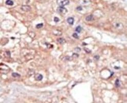 UHMK1 Antibody in Immunohistochemistry (IHC)