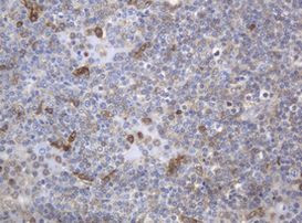 KIT Antibody in Immunohistochemistry (Paraffin) (IHC (P))