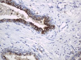 KIT Antibody in Immunohistochemistry (Paraffin) (IHC (P))