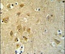 KLC2 Antibody in Immunohistochemistry (IHC)