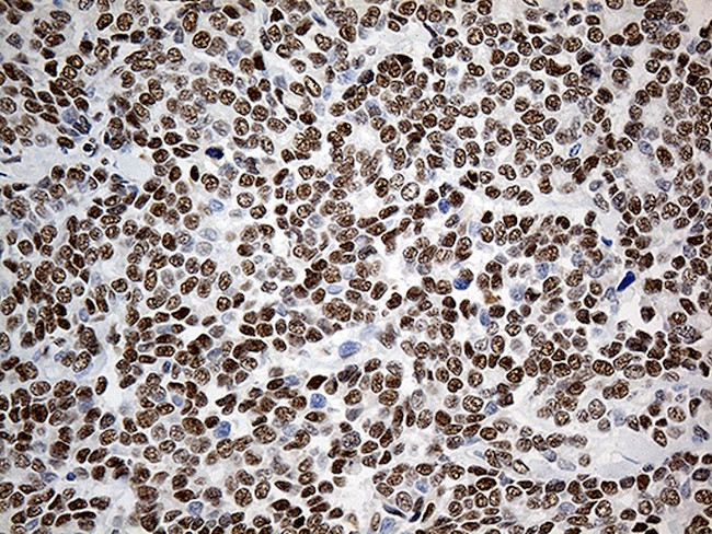 KLF11 Antibody in Immunohistochemistry (Paraffin) (IHC (P))