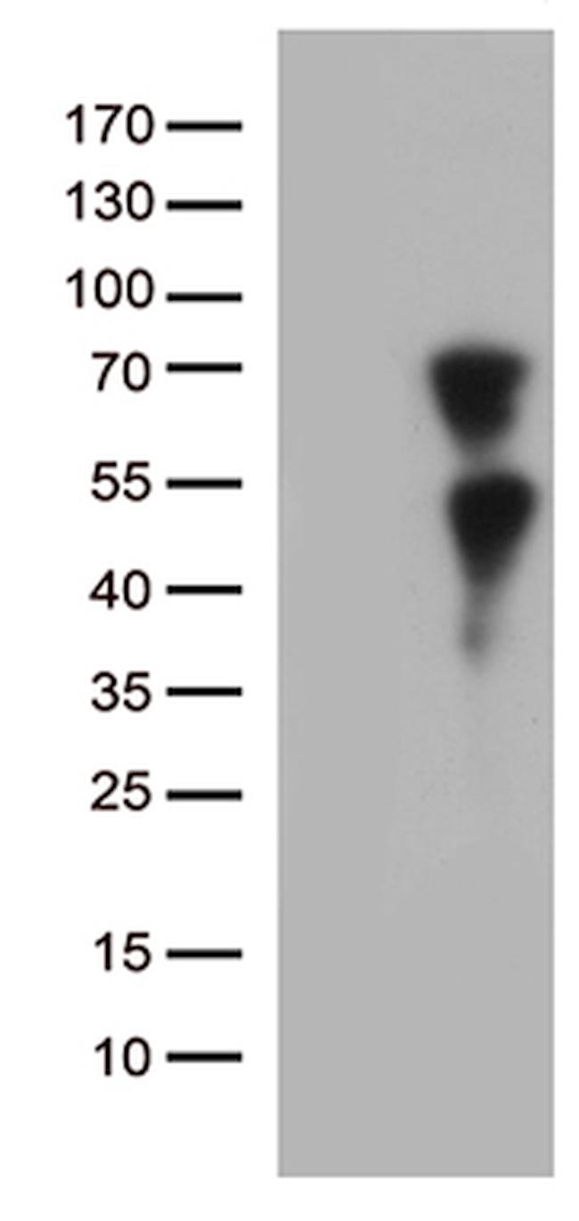 KLF11 Antibody in Western Blot (WB)