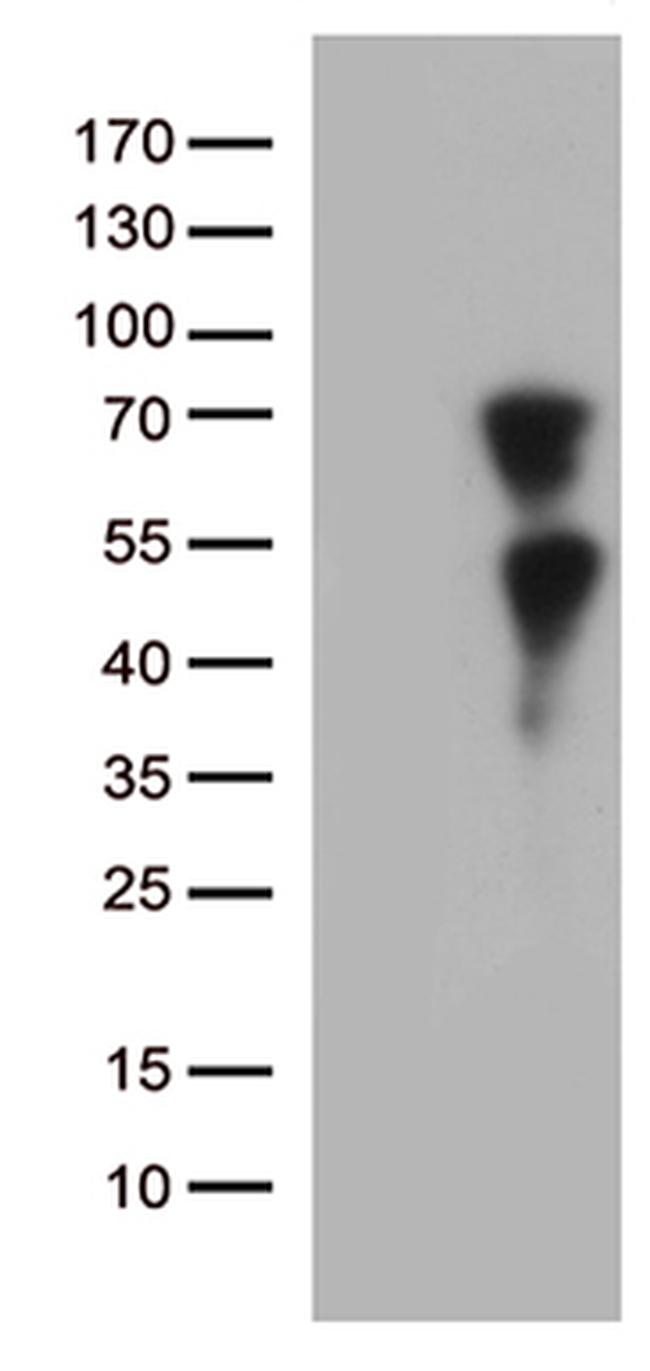 KLF11 Antibody in Western Blot (WB)