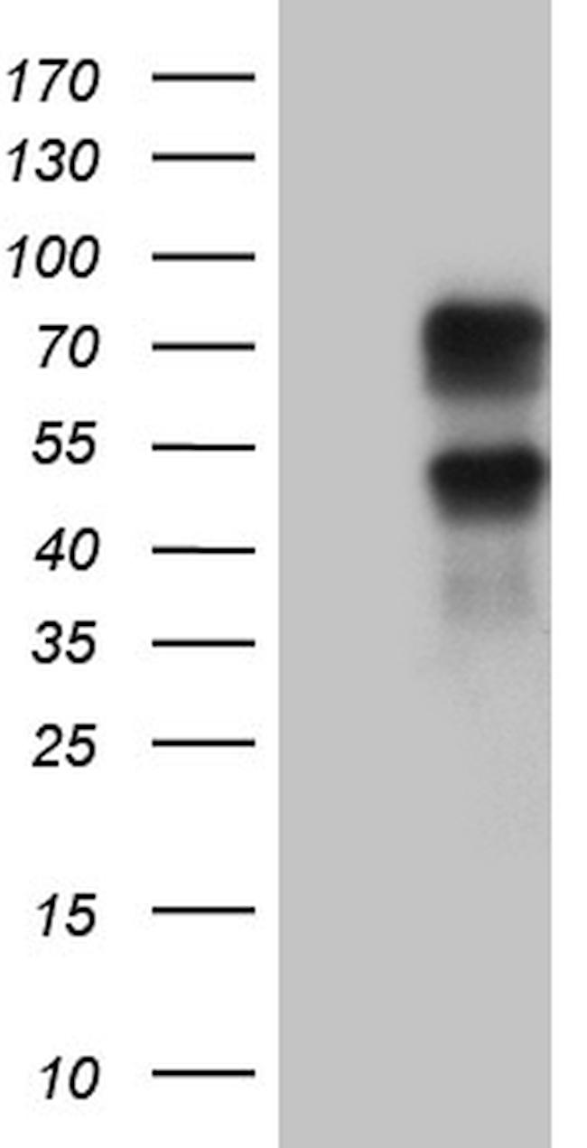 KLF11 Antibody in Western Blot (WB)