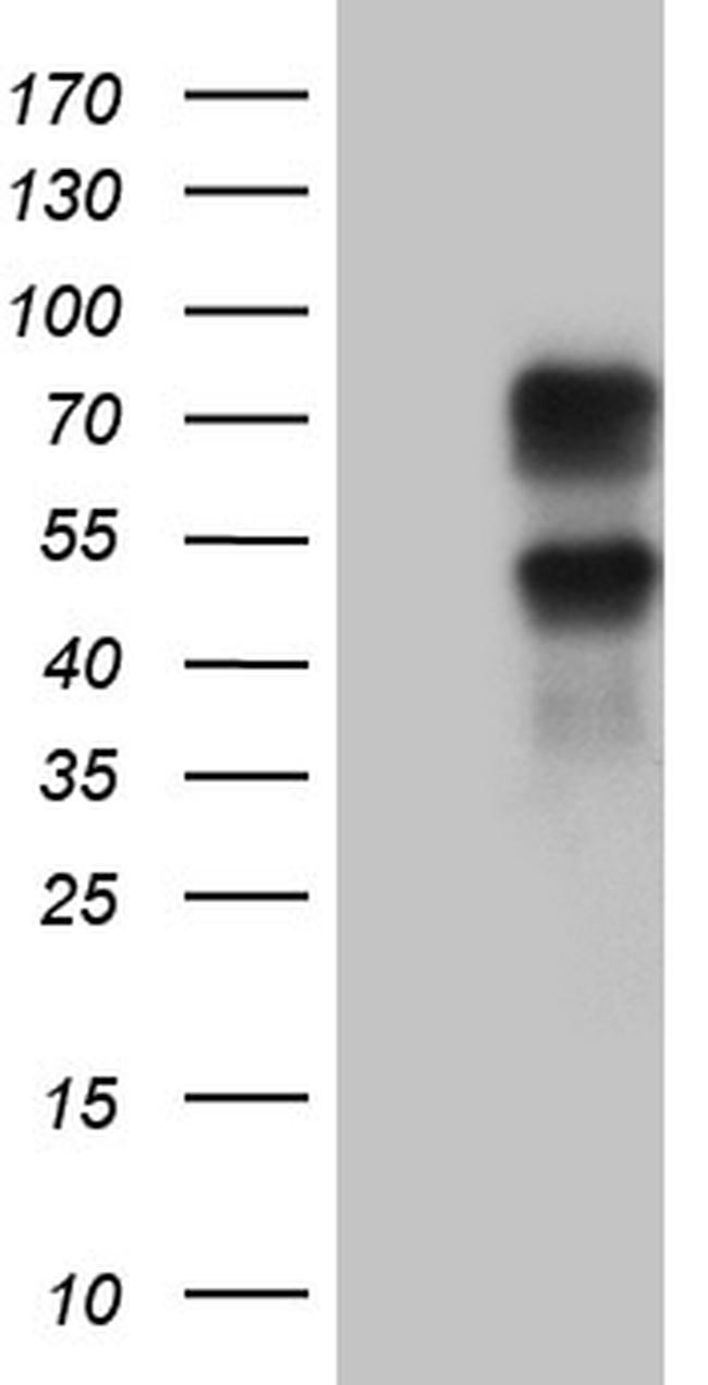 KLF11 Antibody in Western Blot (WB)