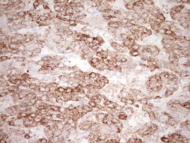 KLF2 Antibody in Immunohistochemistry (Paraffin) (IHC (P))