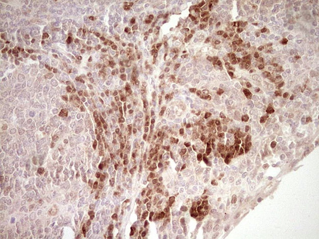 KLF2 Antibody in Immunohistochemistry (Paraffin) (IHC (P))