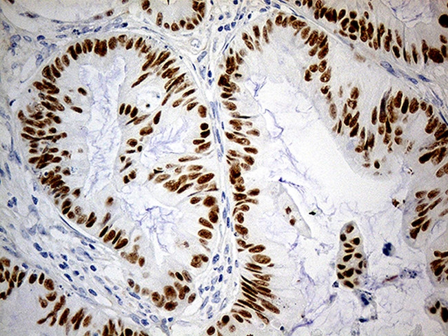 KLF5 Antibody in Immunohistochemistry (Paraffin) (IHC (P))
