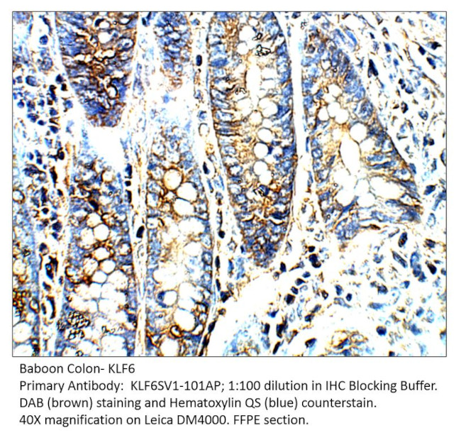 KLF6 SV1 Antibody in Immunohistochemistry (IHC)