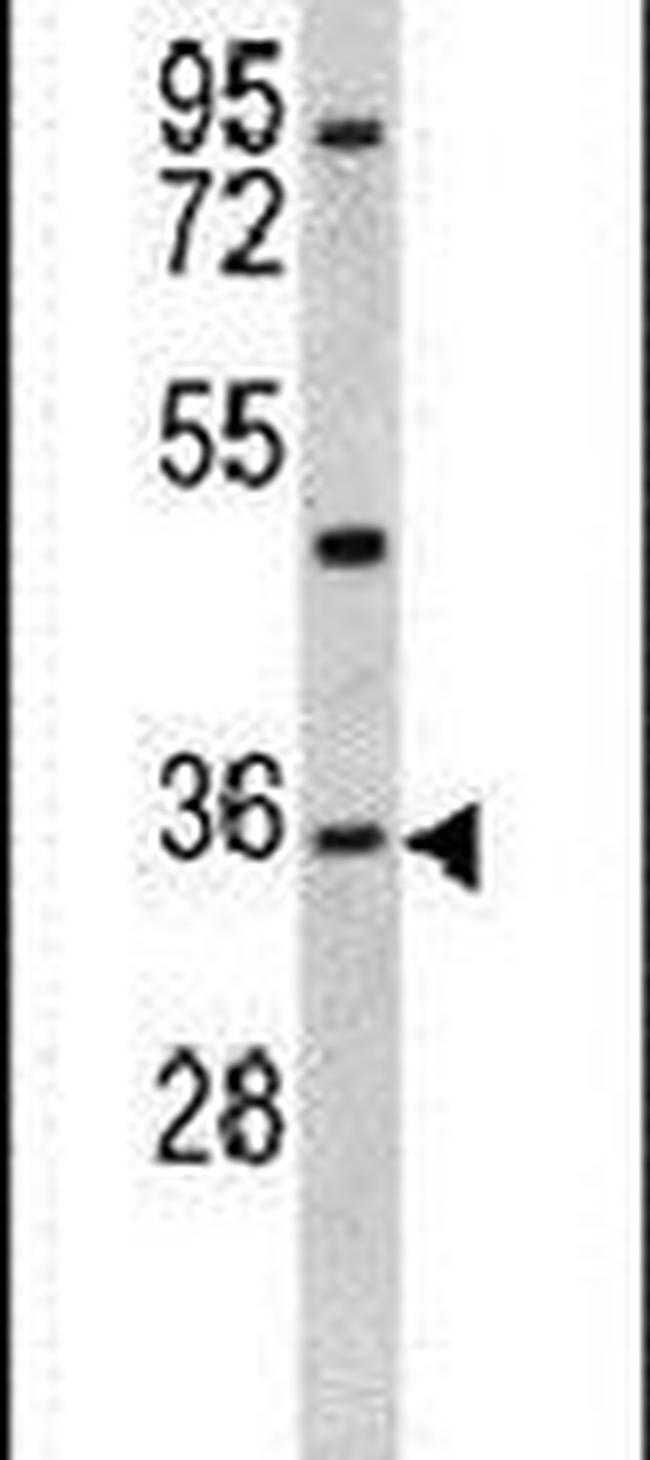 KLF6 Antibody in Western Blot (WB)