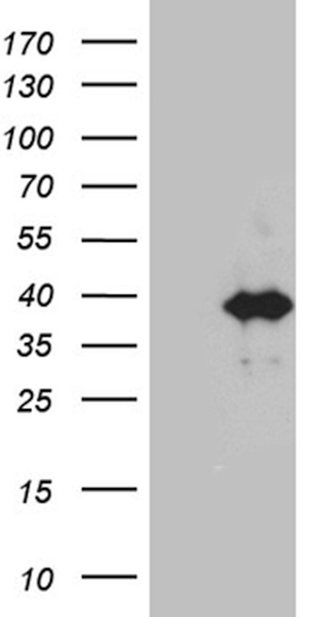 KLF7 Antibody in Western Blot (WB)