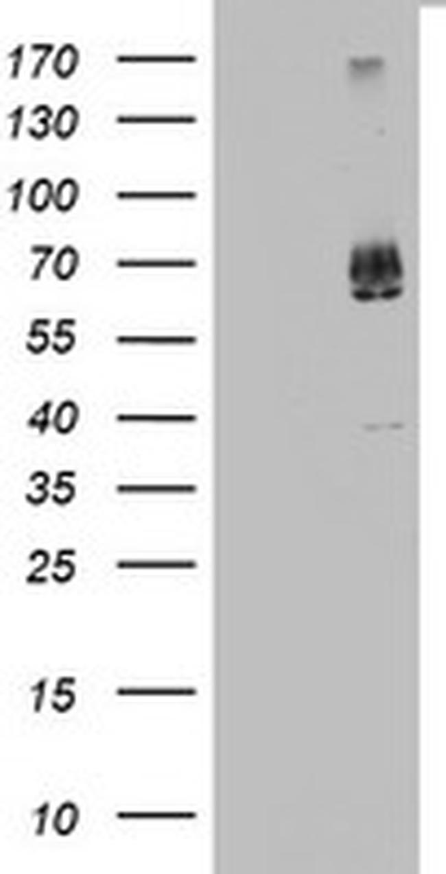 KLHL12 Antibody in Western Blot (WB)
