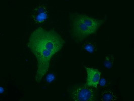 KLHL2 Antibody in Immunocytochemistry (ICC/IF)