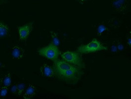 KLHL2 Antibody in Immunocytochemistry (ICC/IF)